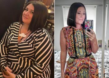 41-Year-Old Mom Sheds 7 Stone in a Year with Fat Injections, Conquering Chocolate Cravings