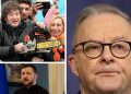 UN to gift Albo global leadership honor