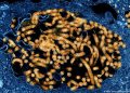 WHO declares global emergency over Ebola outbreak