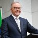 Albanese Honored with Global Citizen Award